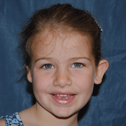Right SU-POR  2015 Lindsay