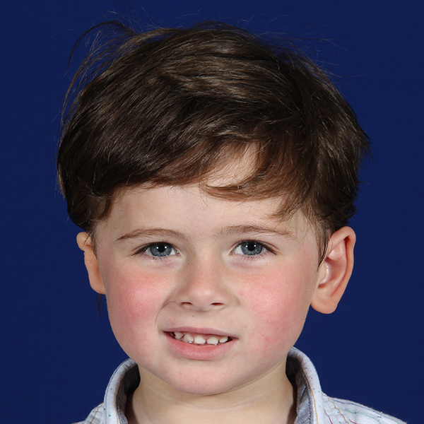 Right Lewin Ear 2018 Liam