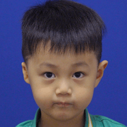 3D Lewin Ear 2019 Early result